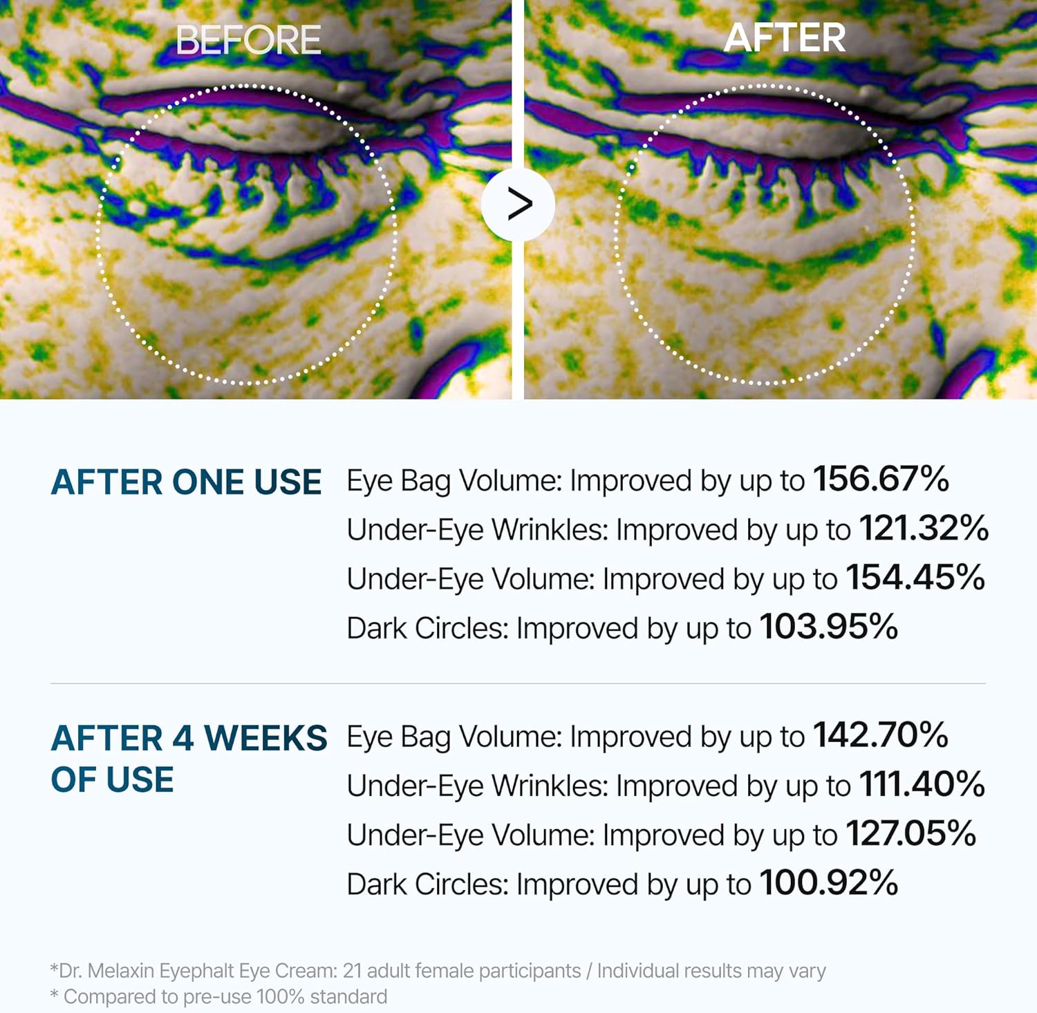 Dr. Melaxin Eyebag Cream - Best Dark Circle & Under Eye Bag Remover | UAE